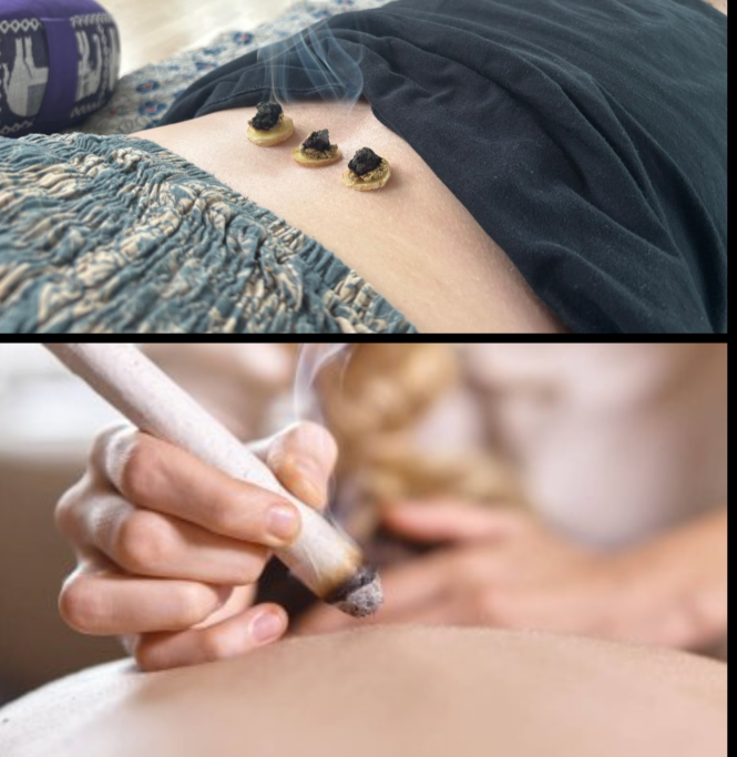 Moxibustion